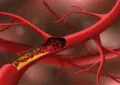 What Is Cholesterol And How To Manage Your Cholesterol Levels? 7 What Is Cholesterol And How To Manage Your Cholesterol Levels?